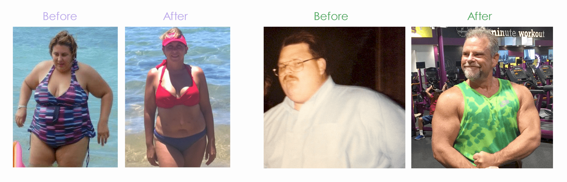 Before After Weight Loss Surgery In Houston Texas Houston