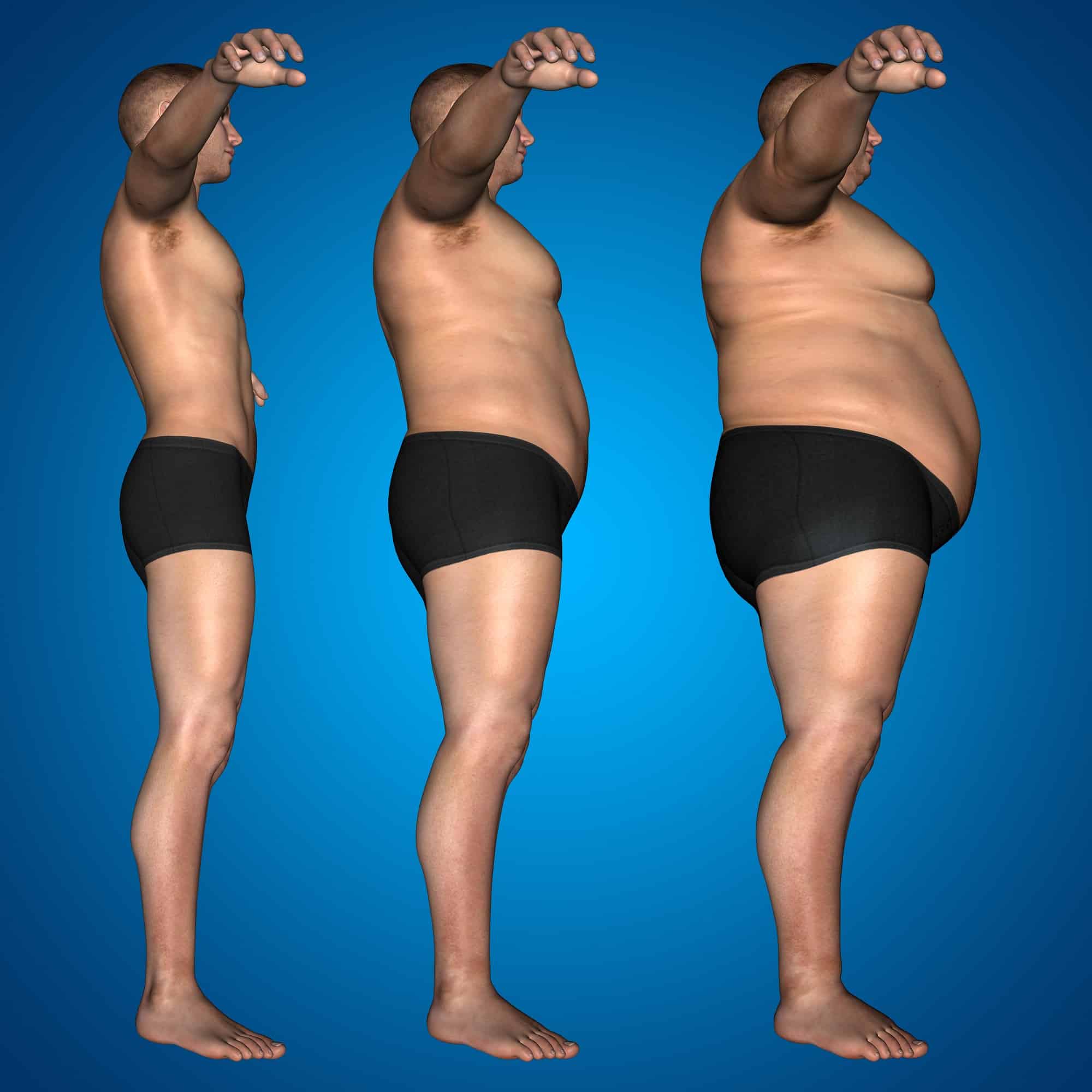 Houston Weight Loss Surgeon - Obesity Trumps Underweight for first time