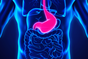G-POEM for Gastroparesis Treatment