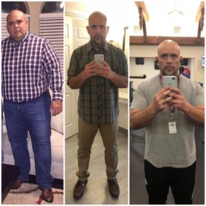 Before-afer-houston-sleeve-surgery